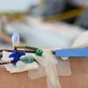Stammzellespenden: Vill potentiell Donateuren decidéieren sech dergéint