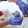 European Testing Week: Et betrëfft net just déi aner | © Croix-Rouge / David Angeletti